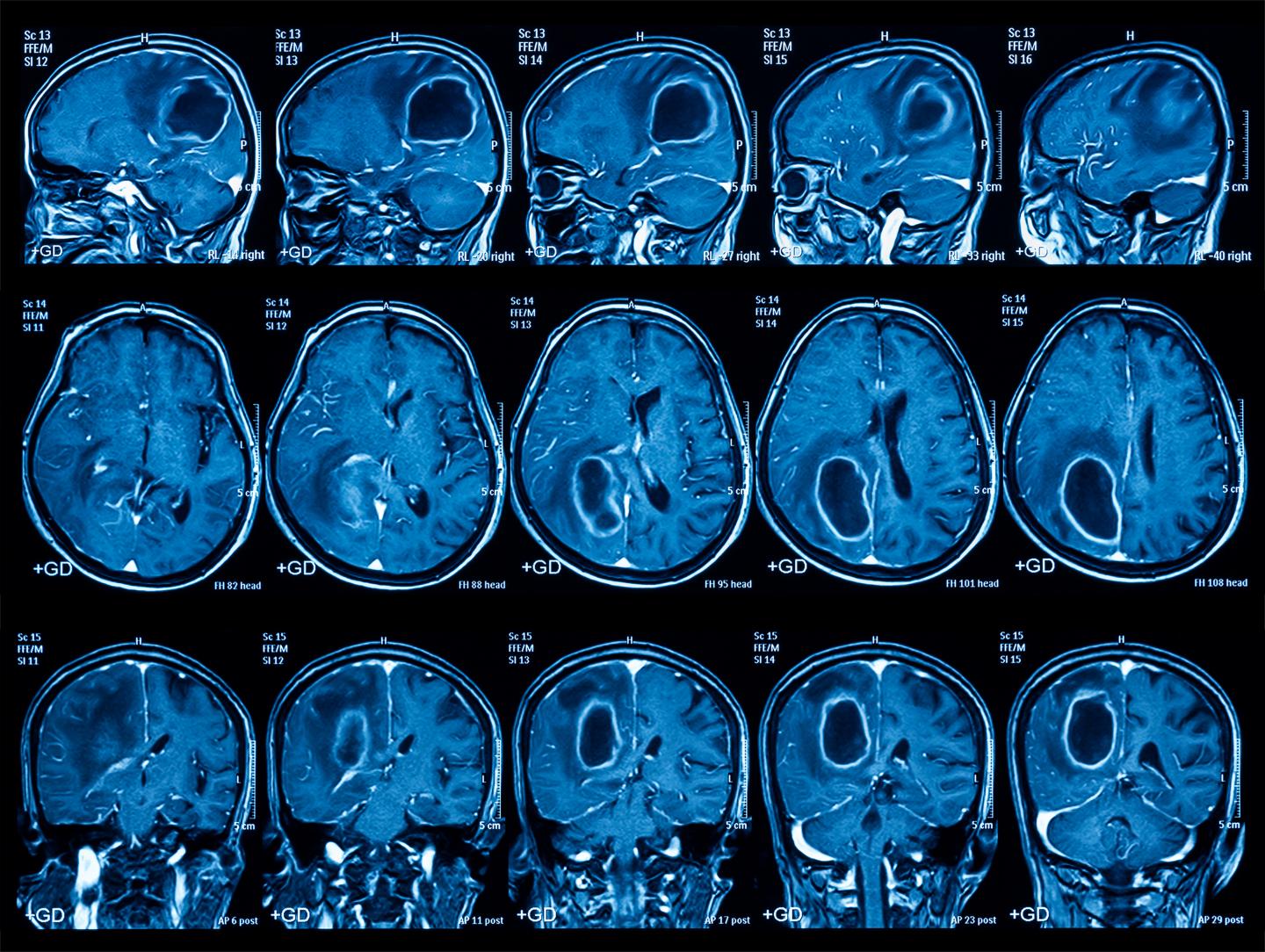 Medical Imaging