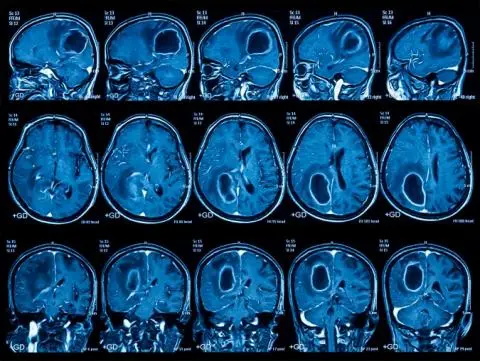 How the LHC could help us peek inside the human brain?