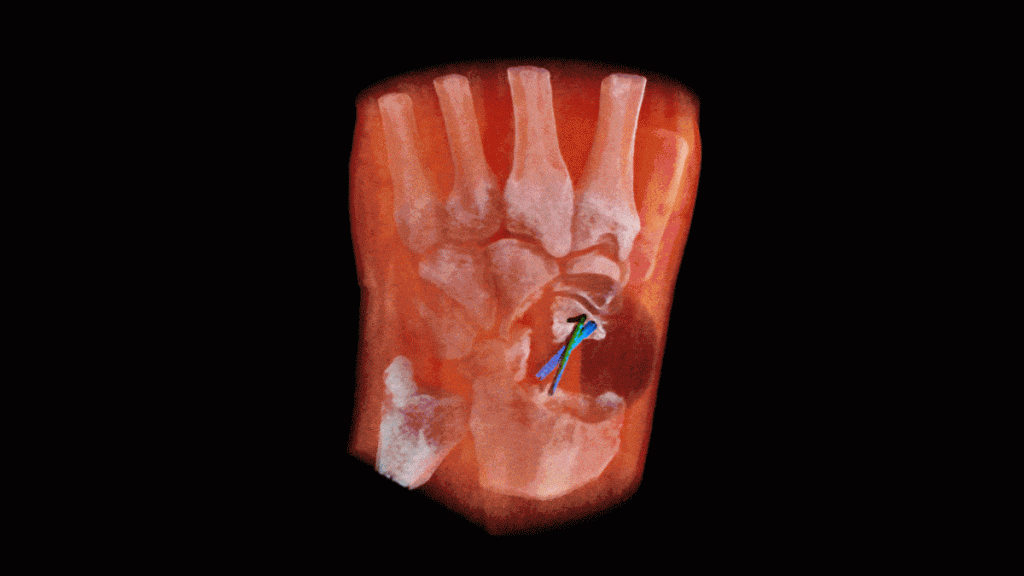 New 3D colour X-rays